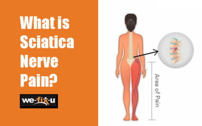 What is Sciatica Nerve Pain – Causes and Symptoms